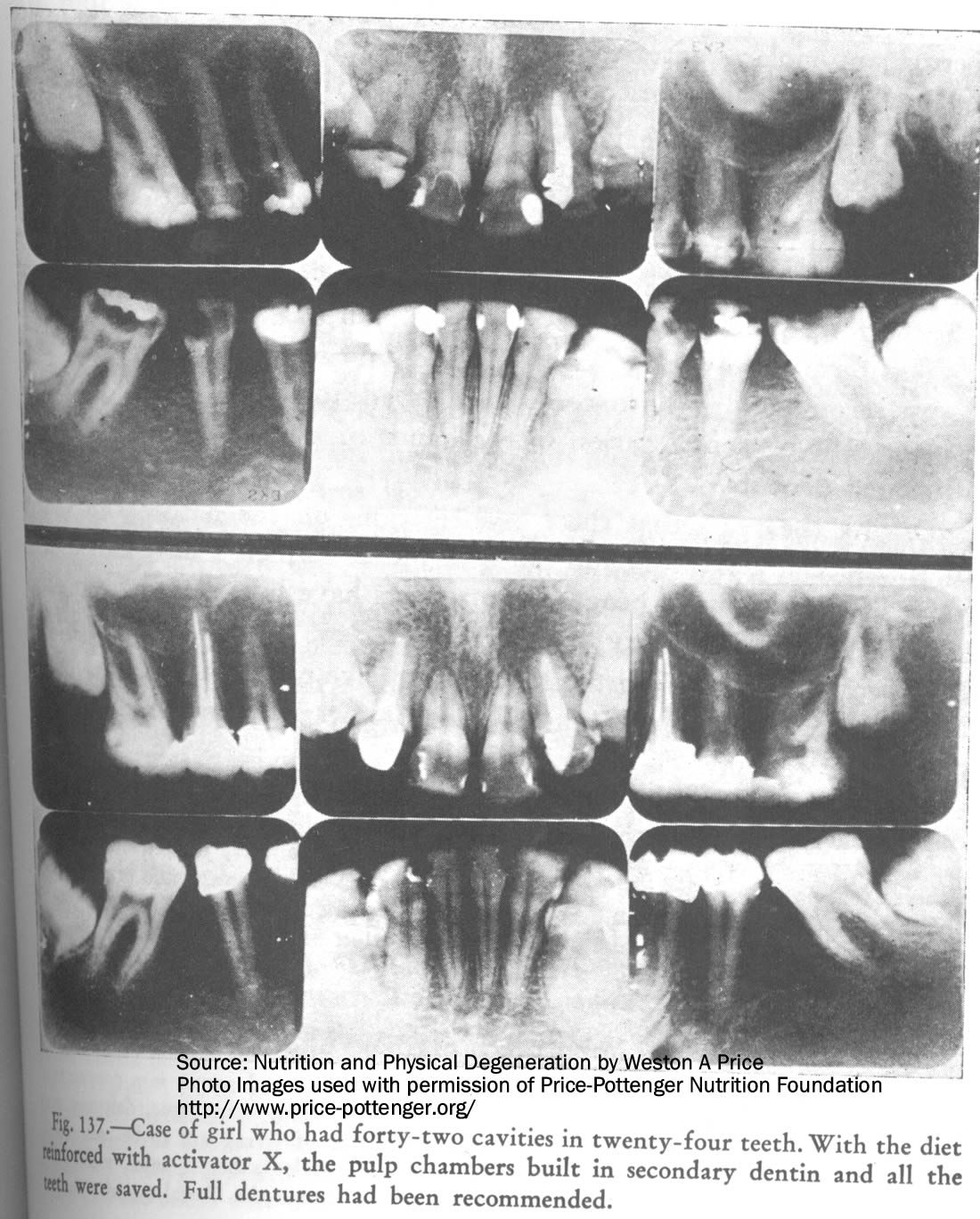 White Cavity