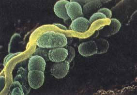 streptococcus mutans carriage