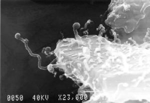 Nanobes
