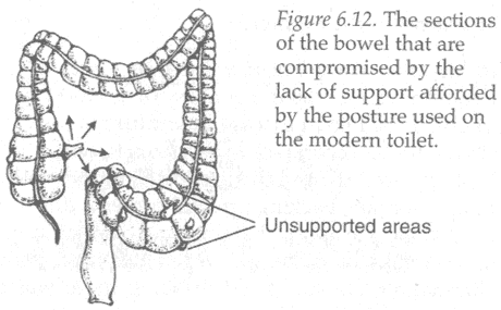 Unsupported Bowels